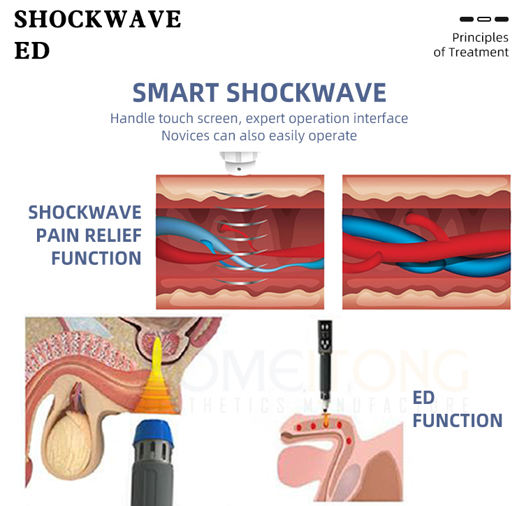 buy medical extracorporeal shock wave machine