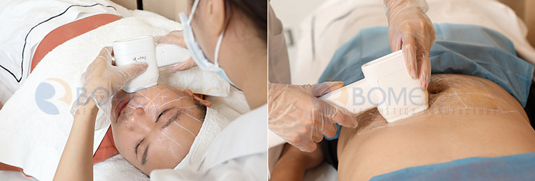 portable hifu device 360 + 12D