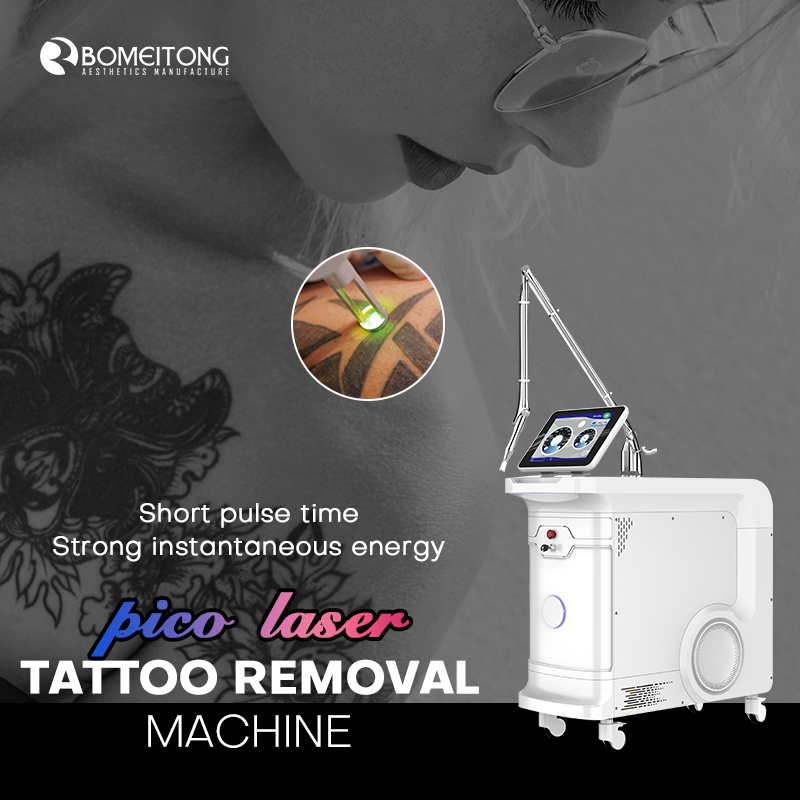tatto removal equipment