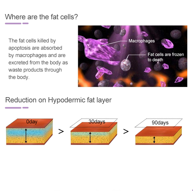 Fat Freezing Cryolipolysis Machine Supplies in Lebanon