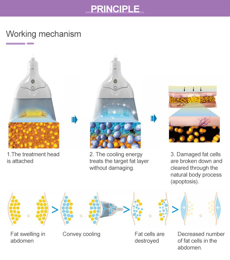 Cryolipolysis Fat Freezing Chin Machine Price in Srilanka