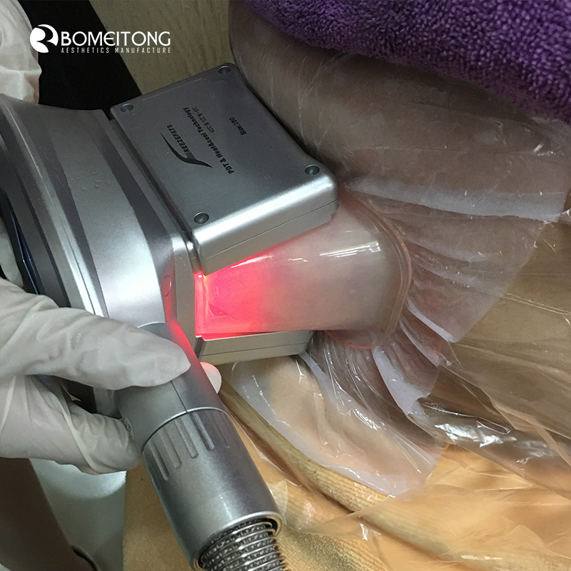 Cryolipolyse Fat Freezing Machine for Double Chin Removal