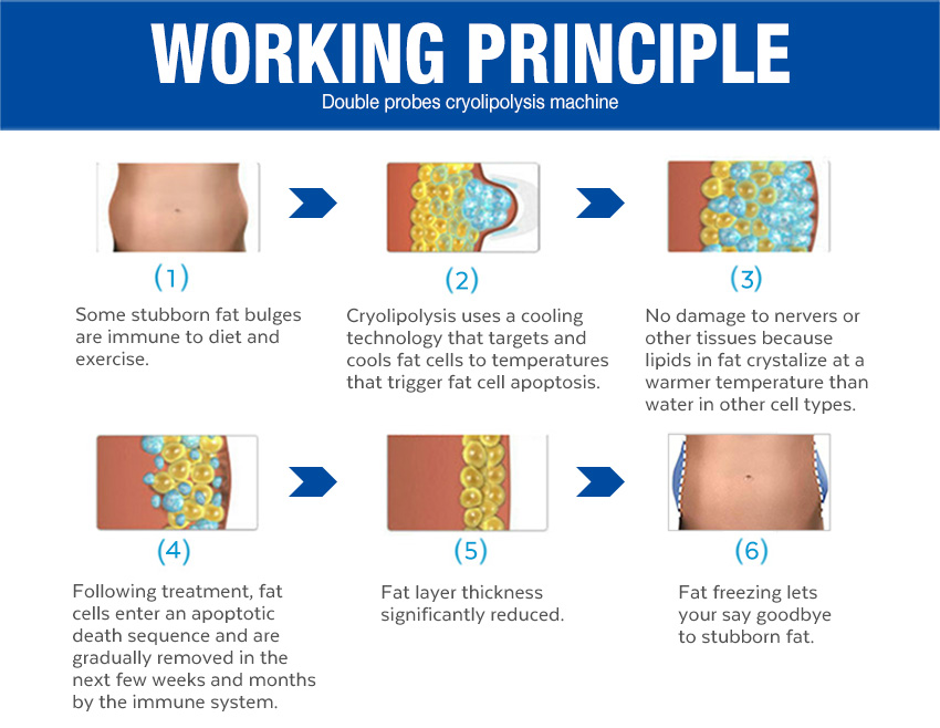 fat freezing equipments principle