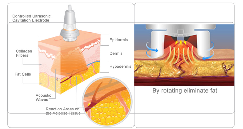 Skin tightening Fat Rotating Cavitation Slimming Machine M9+2S